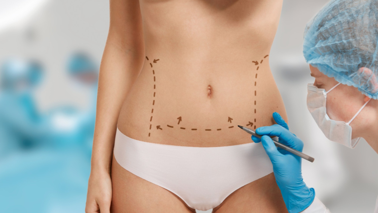 Chirurgie esthétique pour la féminité : sculpter la confiance en soi femme marquée par la chirurgie esthétique