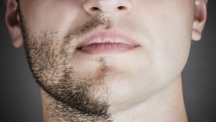 10 Ways to Cover Your Facial Hair 1 47f88ad3f439392282012f9d9622c399