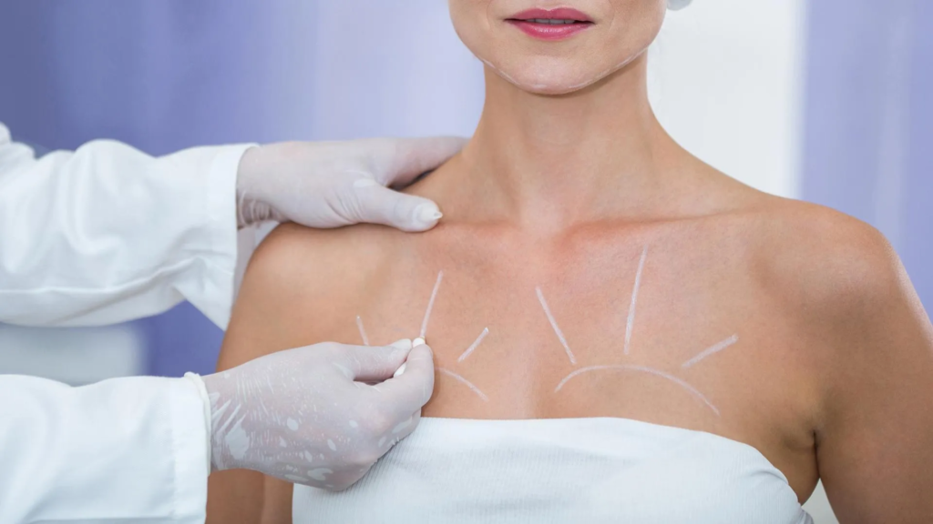 Breast Surgery for Trans Women: Everything You Need to Know 1 breast surgery